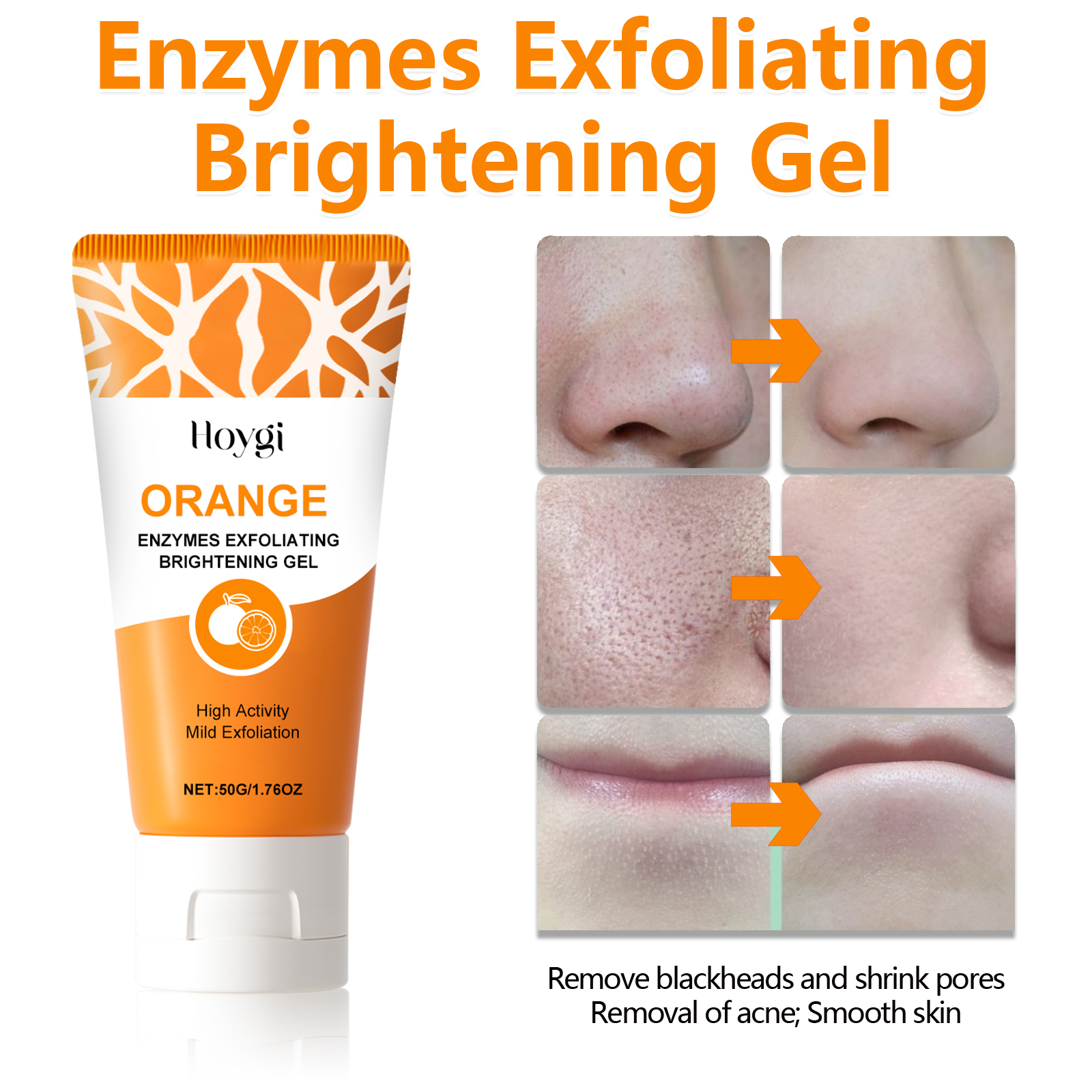 Exfoliating Blackhead Gel with - Aha Bha Exfoliant บทวิจารณ์และราคา