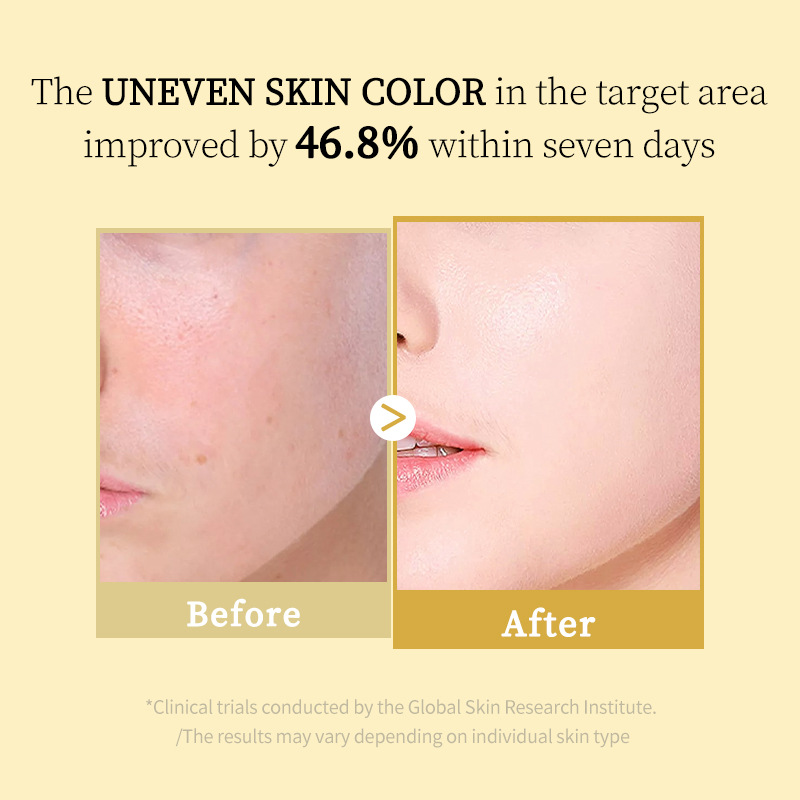 Turmeric VC Collagen gently ex - Aha Bha Exfoliant บทวิจารณ์และราคา