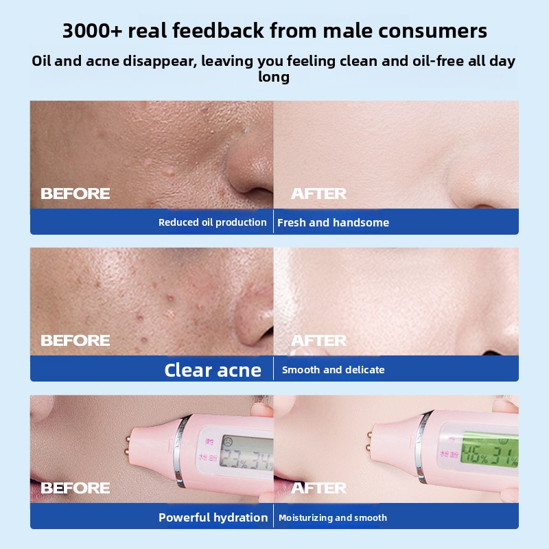 RUYI Men Skin Care Set Salicyl - Skincare Salicylic Acid บทวิจารณ์และราคา