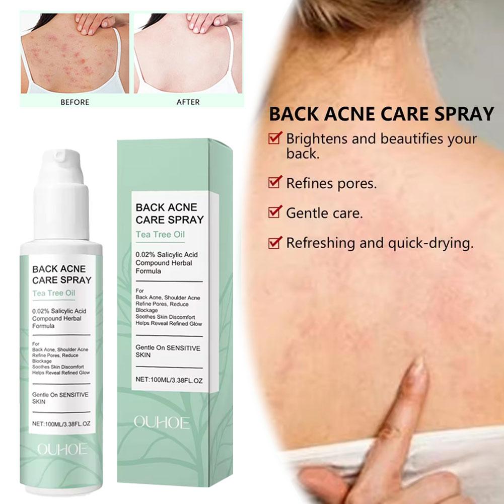 Salicylic Acid Back Acne Spray - Skincare Salicylic Acid บทวิจารณ์และราคา