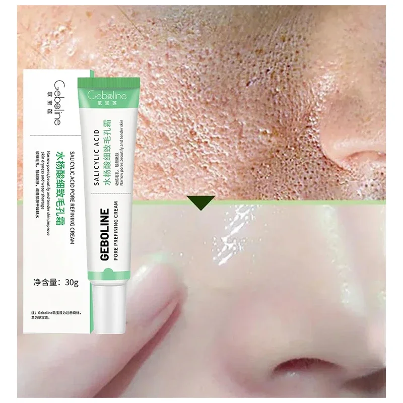 Salicylic Acid Pore Shrinking  - Skincare Salicylic Acid บทวิจารณ์และราคา
