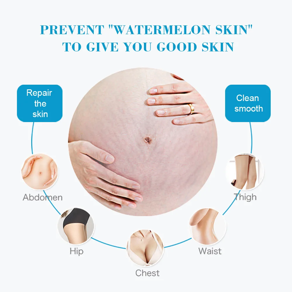 Snail Removes Stretch Mark Cre - Snail Cream Gel บทวิจารณ์และราคา