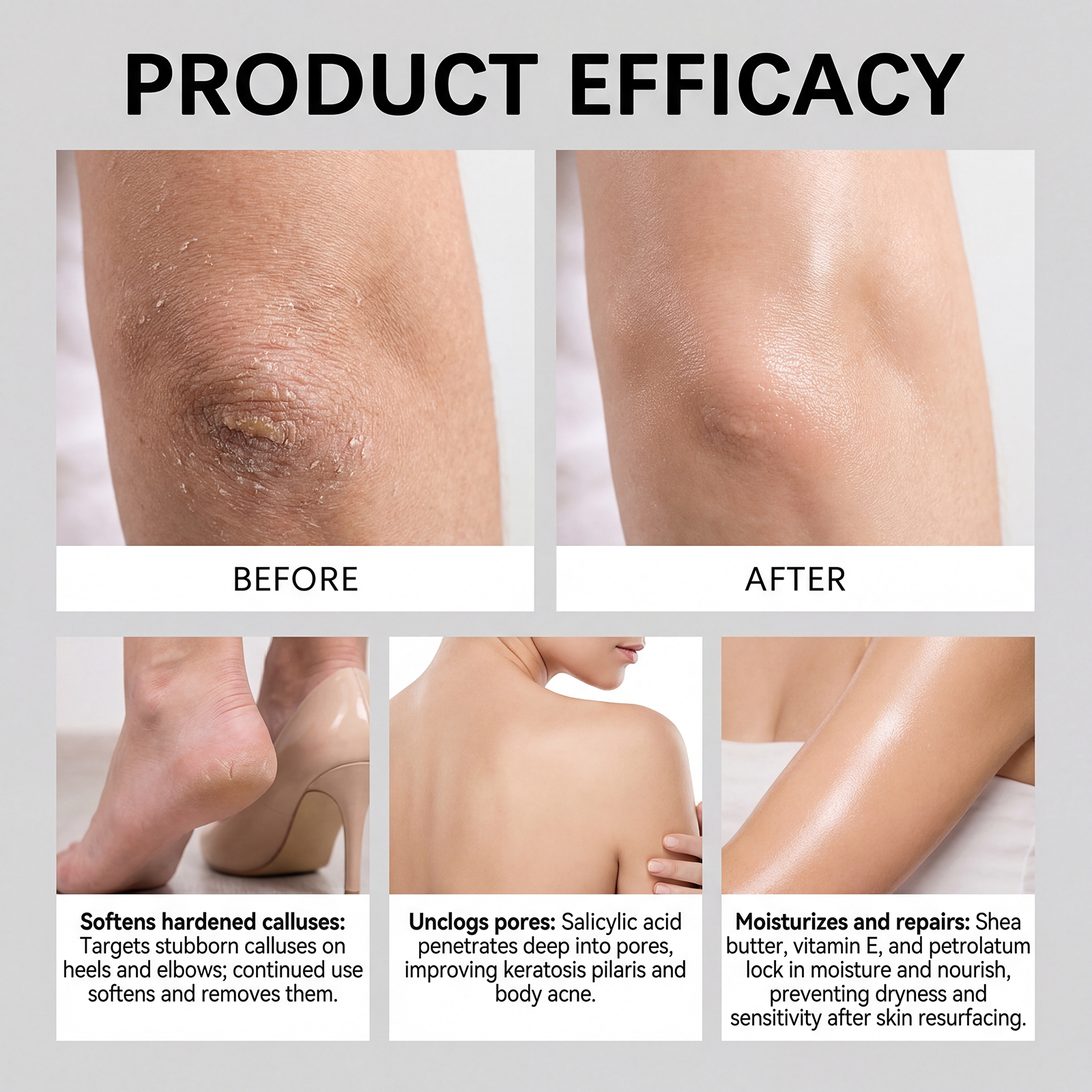 Exfoliating Body Stick Smoothi - Aha Bha Exfoliant บทวิจารณ์และราคา