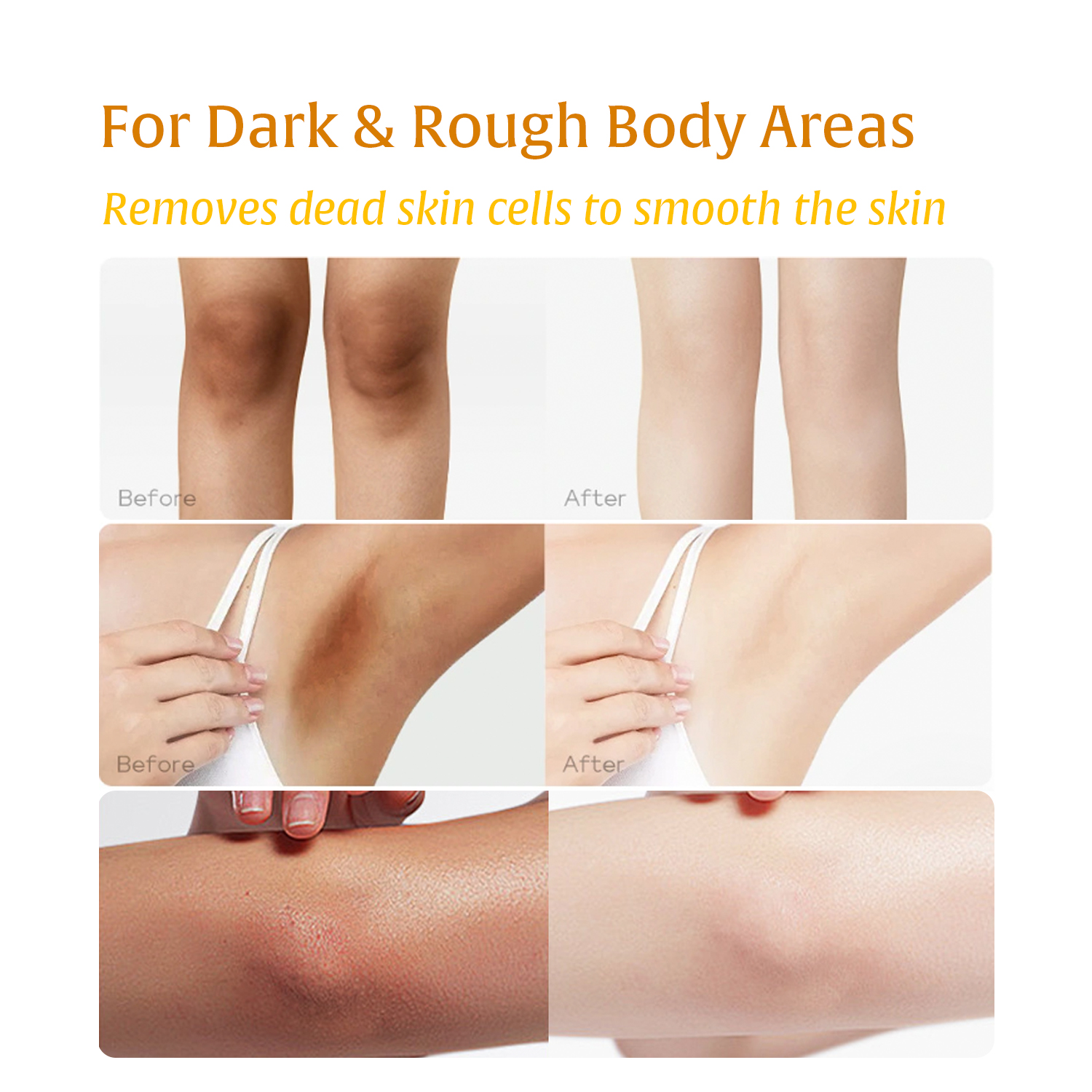 Turmeric Kojic Acid Body Exfol - Aha Bha Exfoliant บทวิจารณ์และราคา