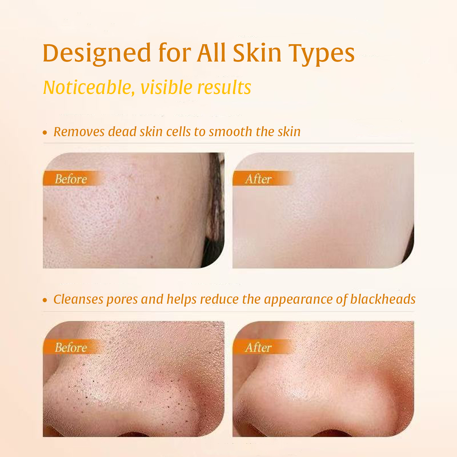 Turmeric Kojic Acid Body Exfol - Aha Bha Exfoliant บทวิจารณ์และราคา