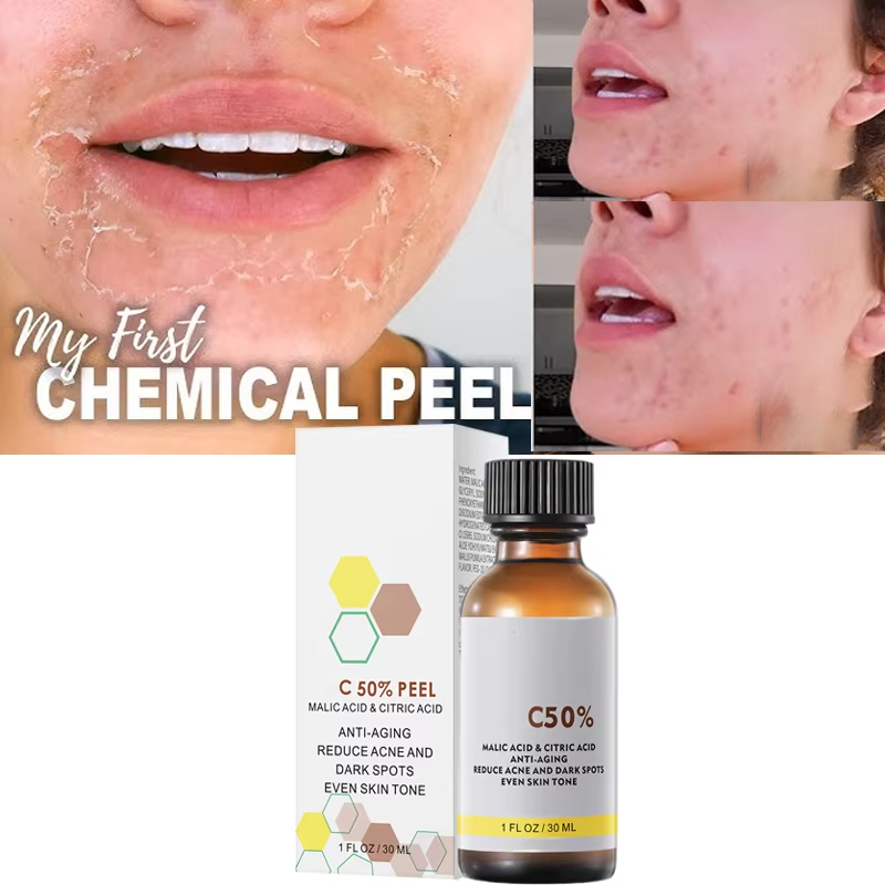 With Malic Acid And Citric Aci - Skincare Salicylic Acid บทวิจารณ์และราคา
