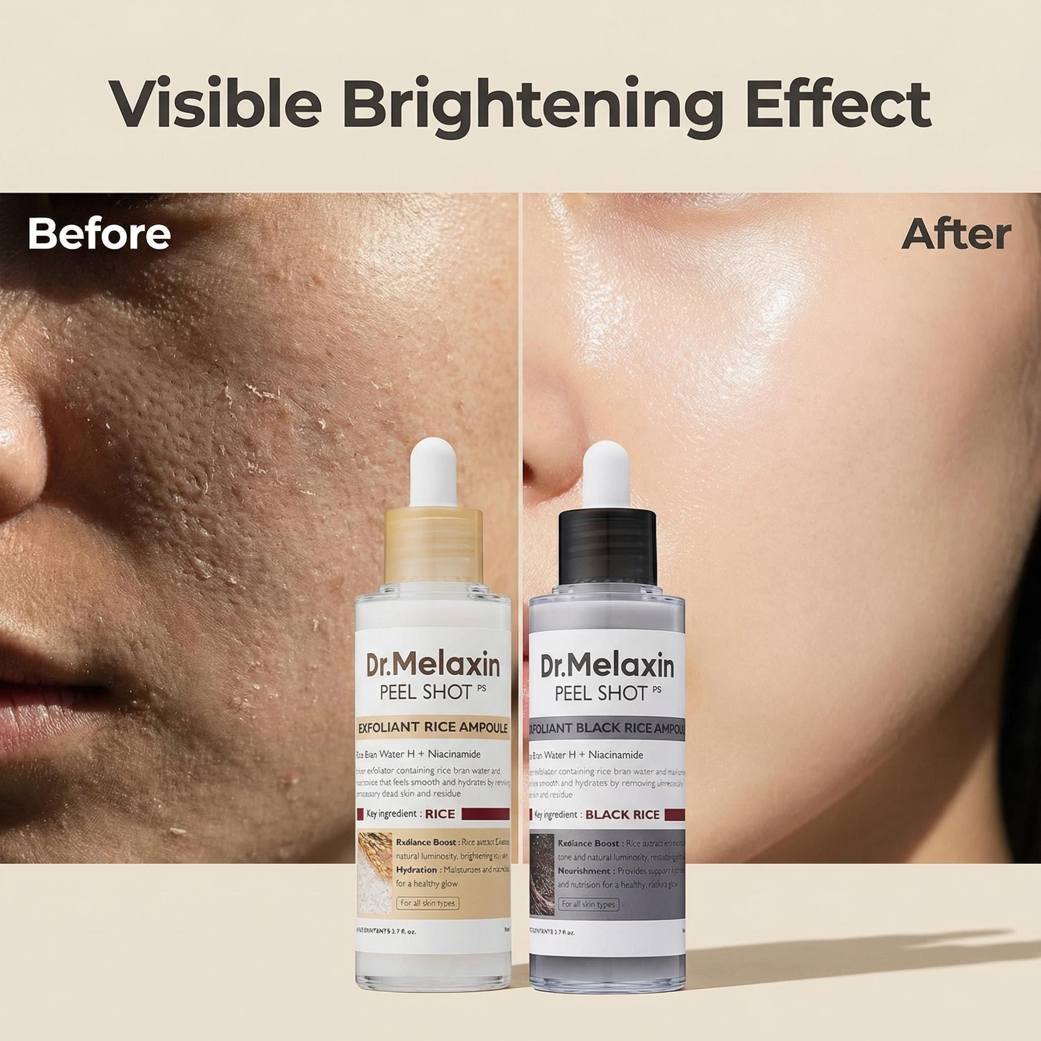 Black Rice Exfoliating Ampoule - Aha Bha Exfoliant บทวิจารณ์และราคา