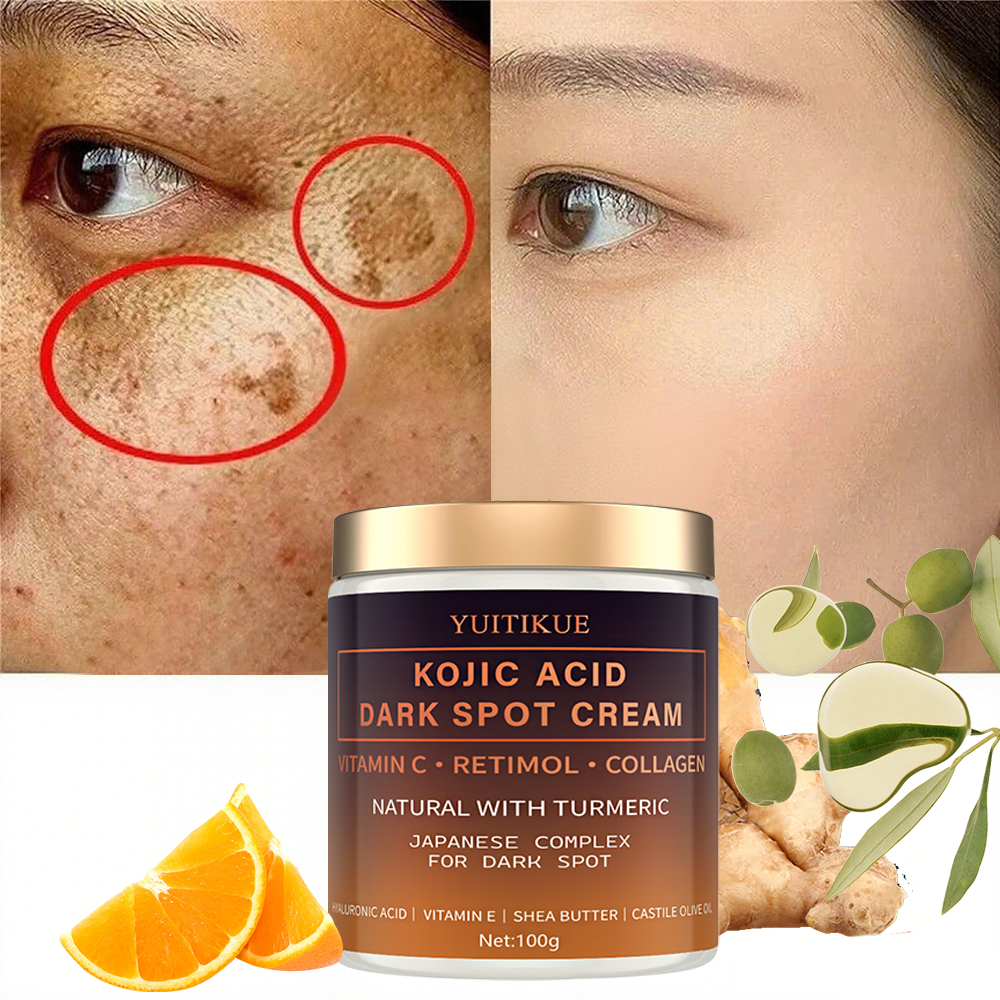 Arbutin fading cream, Vitamin  - Retinol Vitamin A Cream บทวิจารณ์และราคา
