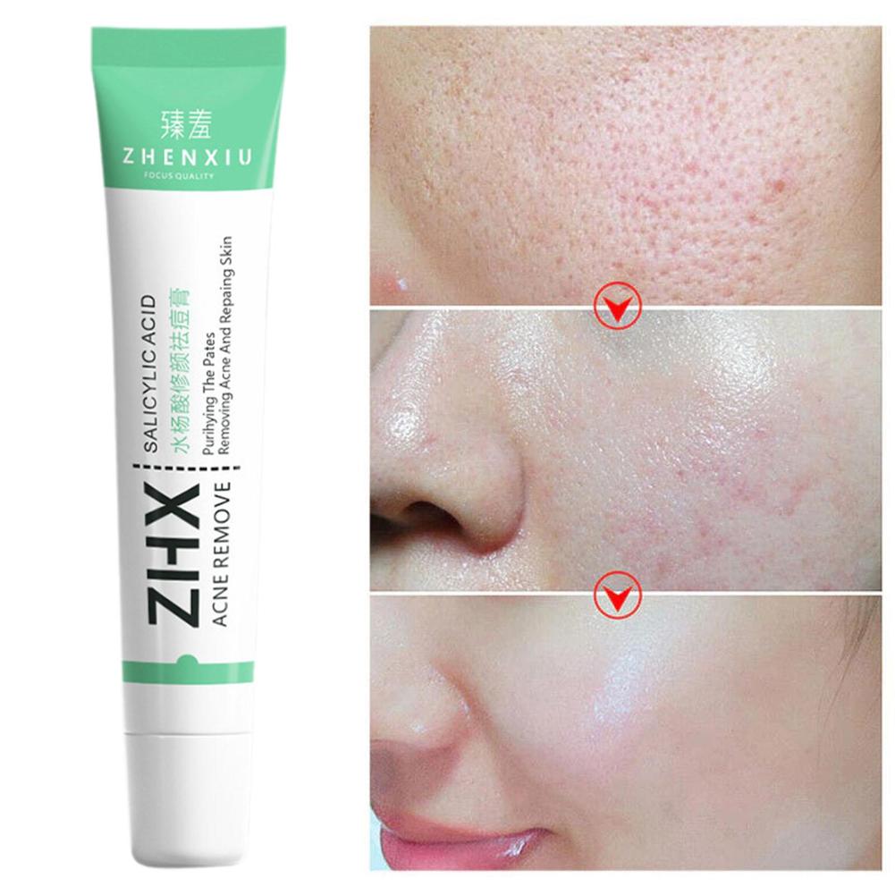 Salicylic Acid Shrink Pore Cre - Skincare Salicylic Acid บทวิจารณ์และราคา